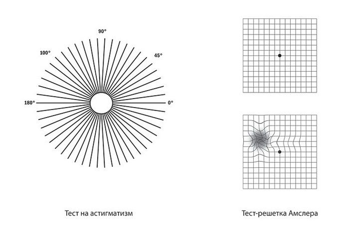 Проверка на астигматизм картинки